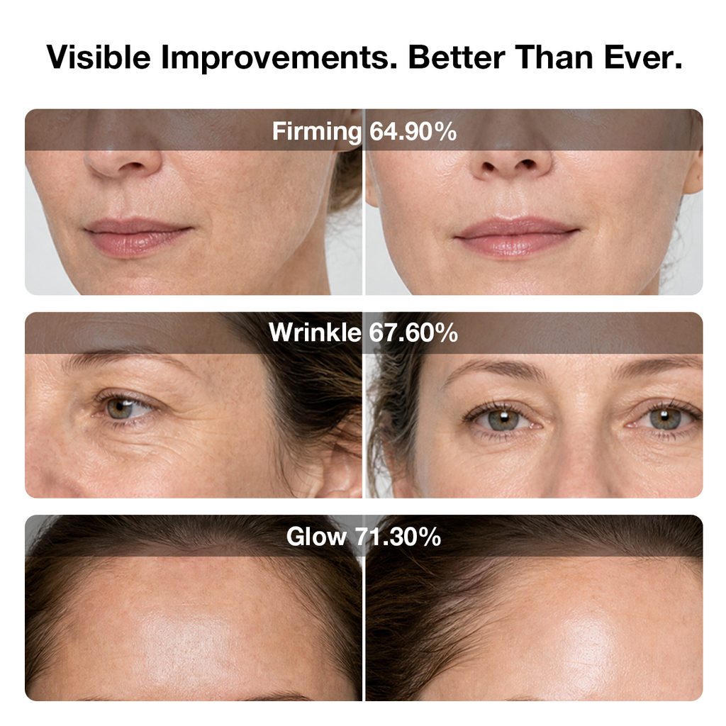 6D Laser & EMS Anti-Aging Therapy Mask