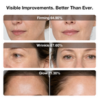 6D Laser & EMS Anti-Aging Therapy Mask
