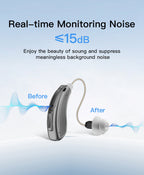 Coniler Bluetooth Hearing Aids with Smart App Self-Fitting, Personalized Hearing, Noise Reduction, Tinnitus Masking & Multiple Sound Modes