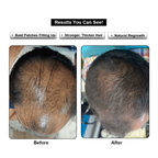 Hair ReGrowth Serum
