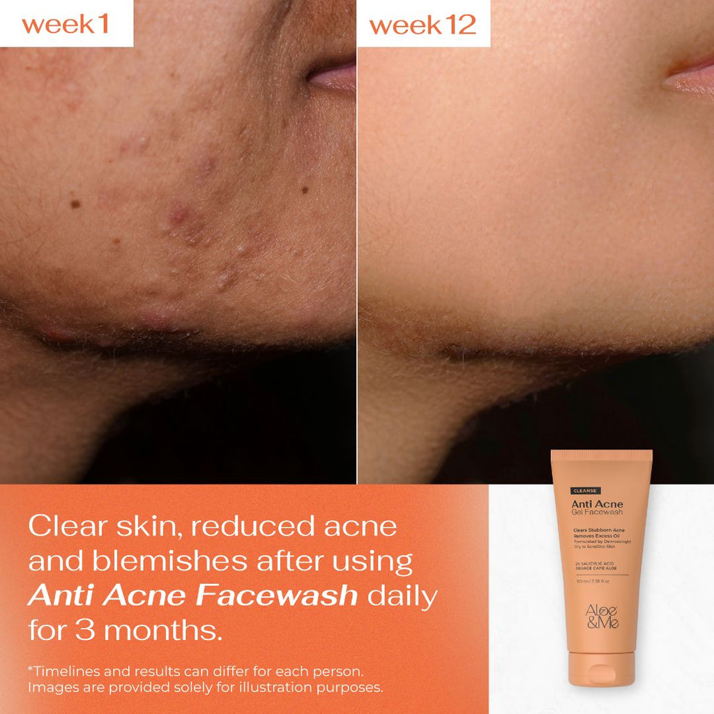 Anti-Acne Gel Face Wash with Salicylic Acid & Niacinamide for Pimples