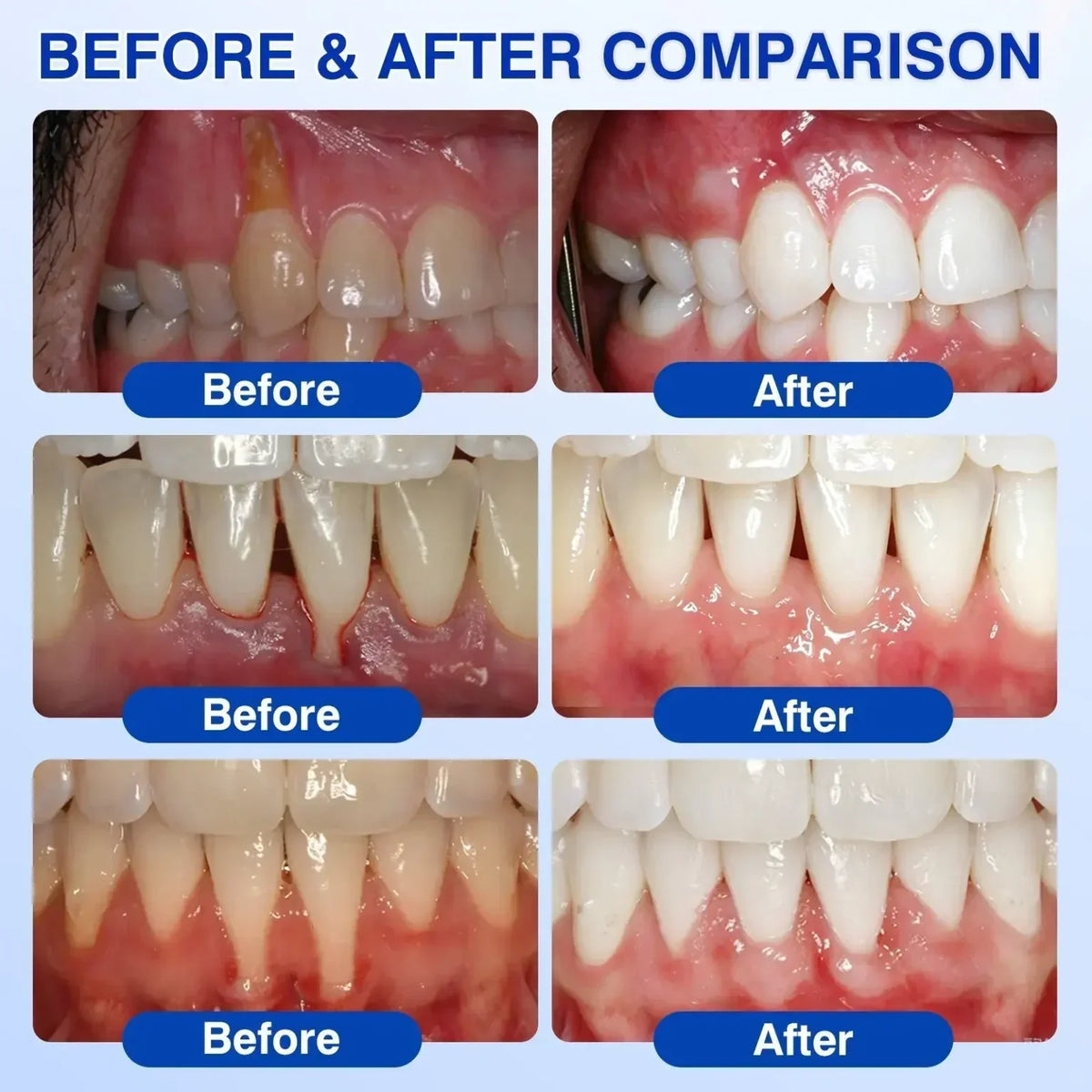 TIWORLD ® Gum health Periodontal Repair Gel