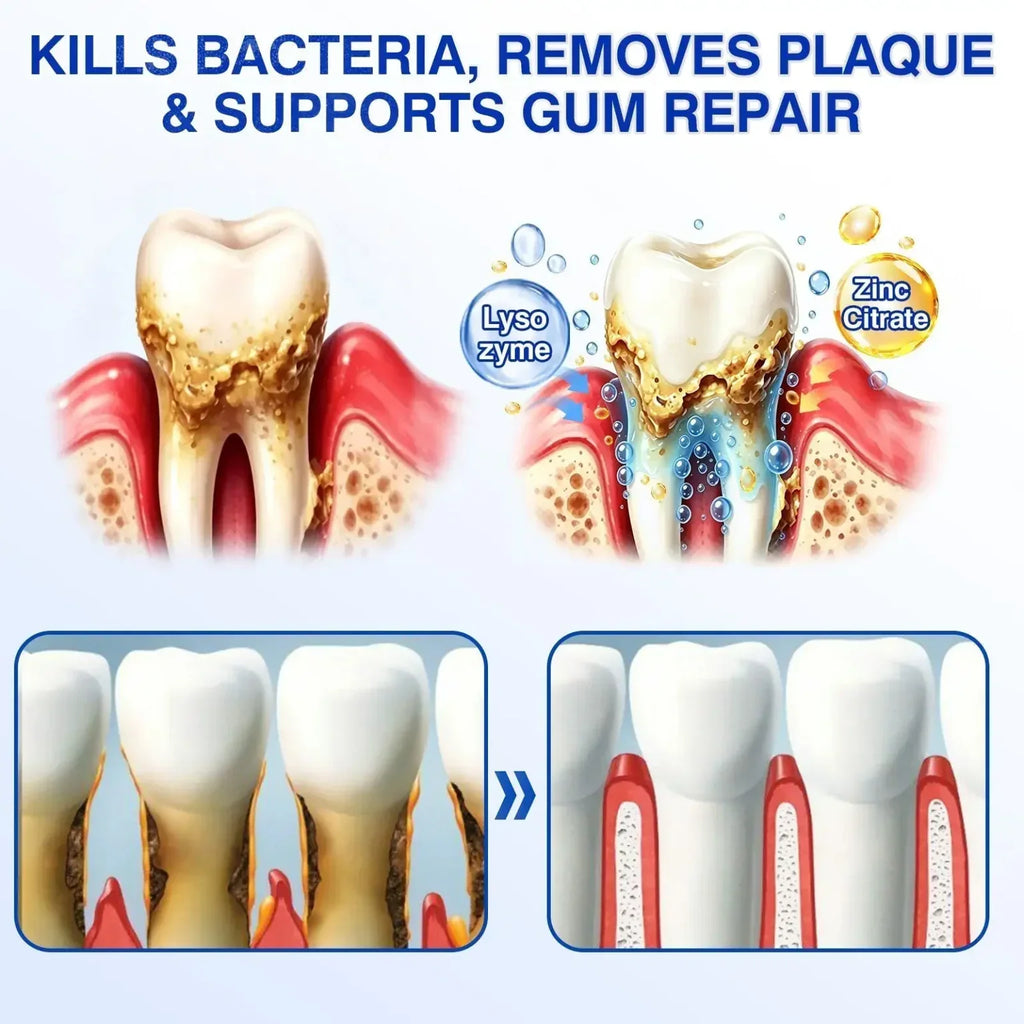 TIWORLD ® Gum health Periodontal Repair Gel