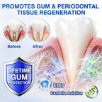 TIWORLD ® Gum health Periodontal Repair Gel